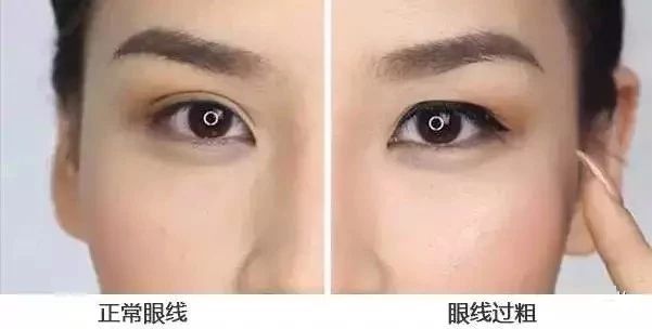 眼線(xiàn)問(wèn)題
